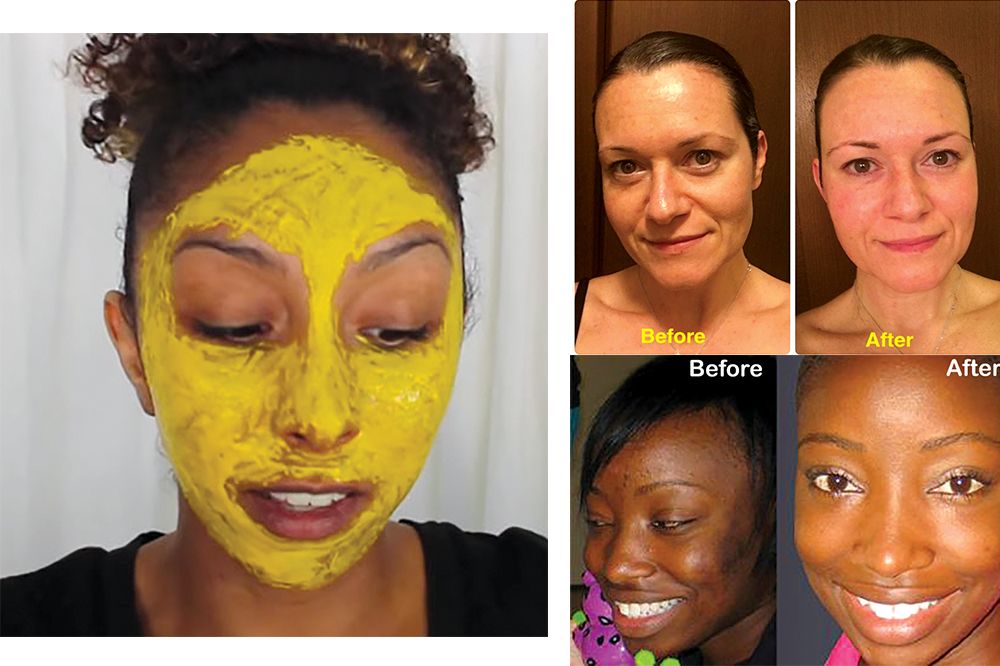 Turmeric mask