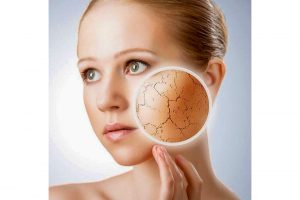Dealing with Dry Skin Patches
