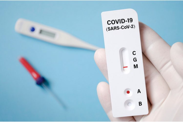 Covid19 Home Rapid Antigen Tests Approved by MOHWE for two-week period