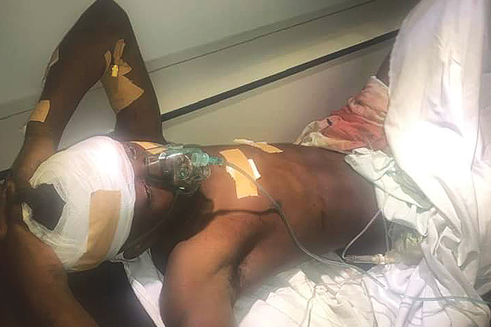 Survivor of collapsed rum factory wall needs help – Mother - Vimarsana News