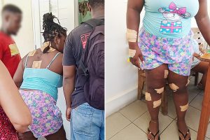Villa woman in  hospital after being stabbed over 20 times