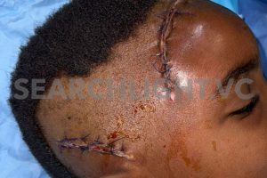 Mother contemplating taking legal action