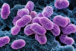 Ministry of Health monitoring drug-resistant bacteria at Milton Cato Memorial Hospital