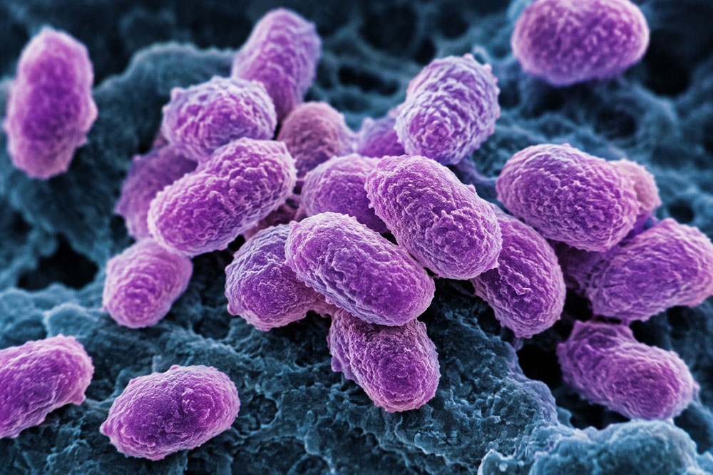 Ministry of Health monitoring drug-resistant bacteria at Milton Cato Memorial Hospital
